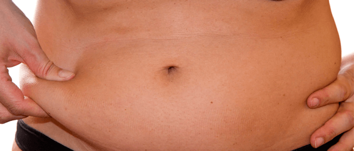 mulher apertando a gordura da barriga - cirurgia de redução de estômago