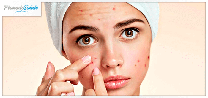 Mulher espremendo espinhas - acne
