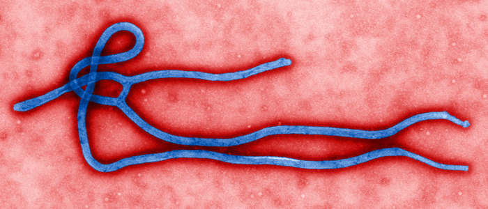 Vírus ebola visto no microscópio